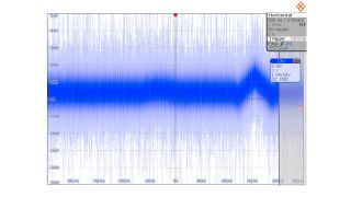 在执行“自动设置”之后捕捉的 ECG 信号。